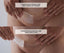 Scar Strips - Silicone Gel